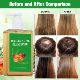 Champú De Aceite De Batana 300ml, Champú Para Dar Volumen