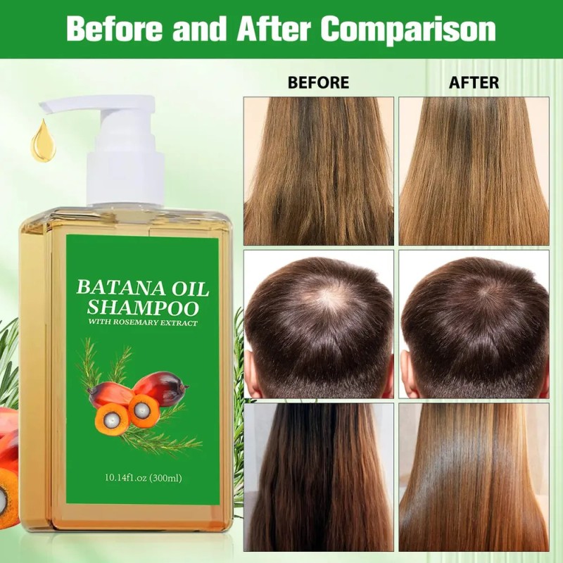 Champú De Aceite De Batana 300ml, Champú Para Dar Volumen