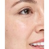 Parche Hidrocoloide Para Espinillas Y Acne Para Granos 36pzs