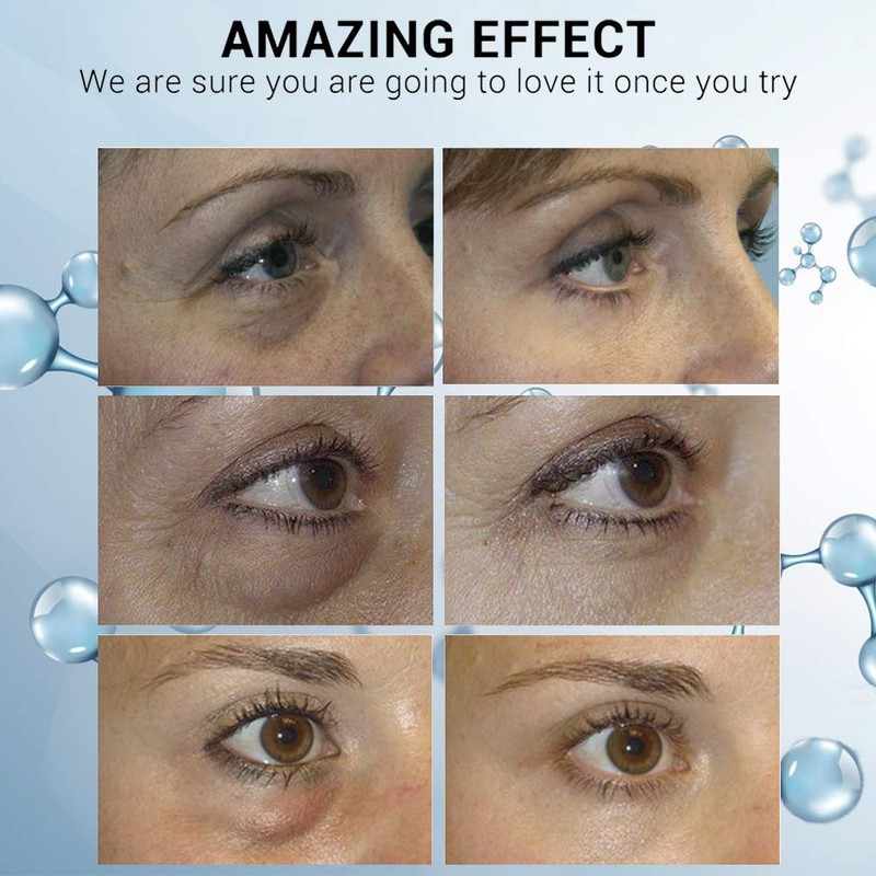 25 x 20ml Sterile Saline Eye Wash Pods