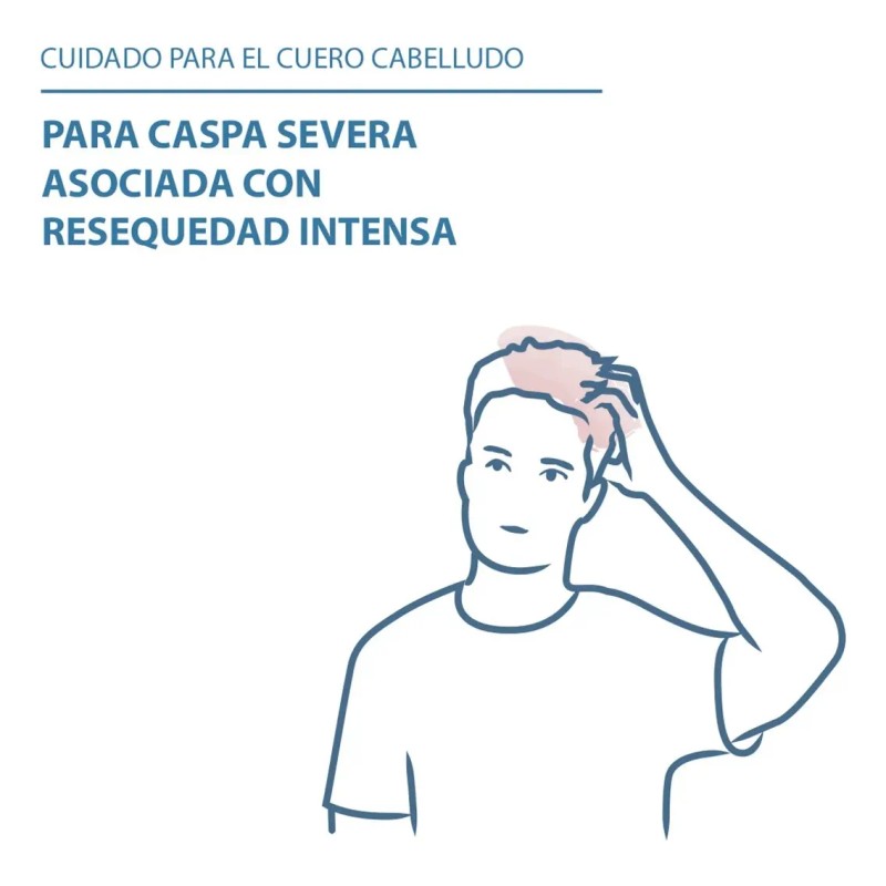 Ducray Kelual Ds Shampoo Tratamiento Para Caspa Severa 100ml