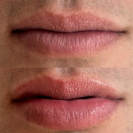 Chaddy Matte Lip Plumper - Hydrating Lip Plumper with Hyaluronic Acid | Plumping Lip, Natural Lip Care and Enhancer - 0.5 fl.oz (Original Flavor)