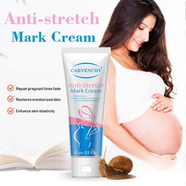Ezyuanchly Stretch Mark Cream for Women,Scar Cream Body Moisturizer, Reduce The Look of Scars and Stretch Marks,Body Tightening Cream for Scars & Stretchmarks, All Skin Types