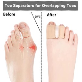 2PCS Gel Toe Separators for Overlapping Toes, Toe Spacers for Bunions Bunion Corrector for Women and Men, 2 Loops Bunion Corrector for First Two Toes