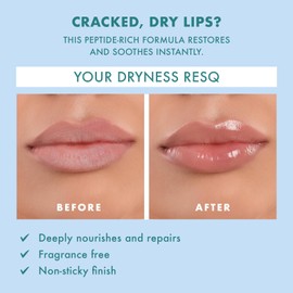 Petal Fresh Skin ResQ Hello Hydration Lip Treatment – Made in Korea – Multi-Peptide Complex 3% + Shea Butter – For Dry, Chapped Lips – Fragrance Free, Deeply Hydrates & Smooths – 0.35 oz (10 mL)