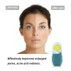 Rodillo Silicona Hielo Masaje Cuidado Facial Reutilizable