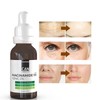 ican london Niacinamide 10% + Zinc 2% For Face Blemish