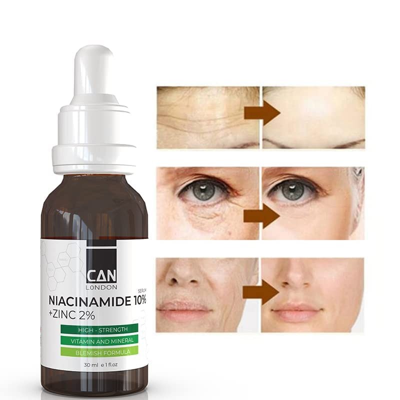 ican london Niacinamide 10% + Zinc 2% For Face Blemish