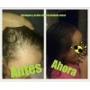 Kit 2 Shampoo + 1 Acondicionador Jusse