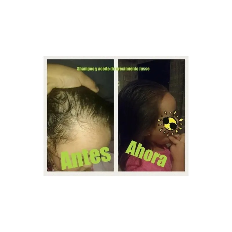 Kit 2 Shampoo + 1 Acondicionador Jusse