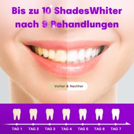 Teeth Whitening Pen (3 Pens) - Instant Whitening Effect for Whiter Teeth | Teeth Whitening Pen with Mint Aroma Against Discolouration | Teeth Whitening with Purple Whitening Gel