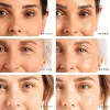 Tree Of Life-pack-sérum De Vitamina C-retinol-ácido Hialurón