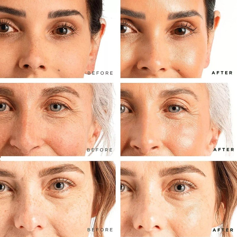 Tree Of Life-pack-sérum De Vitamina C-retinol-ácido Hialurón