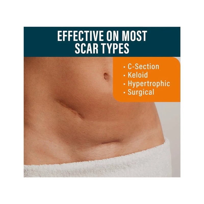 Nuvadermis Scar Sheets Medical Grade Silicone Scar Treatment, 8 Reusable