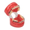 Professional Dental Demonstration Orthodontic Model with Metal Wires and Bracket