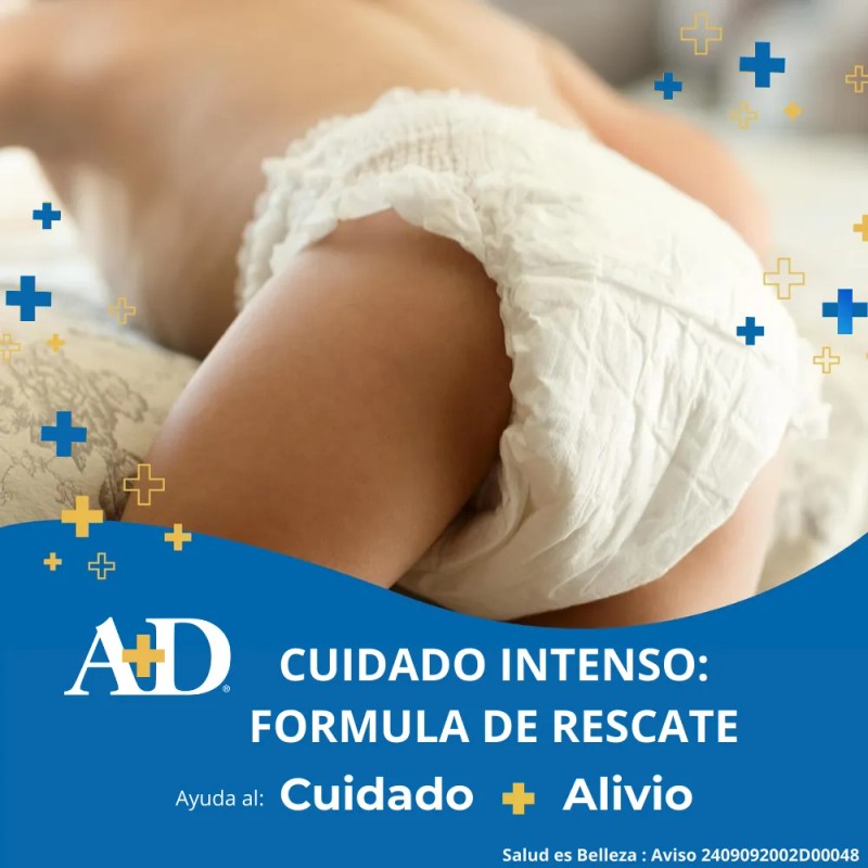 Pomada A+d Cuidado Intenso: Protección Rozaduras Bebé 113g