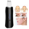 Face Skin Scrubber USB Rechargeable Peeling Machine Ultrasonic Exfoliating SkinCare(Black