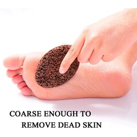 Topinon Lava Pumice Stone for Foot Callus Knees and Elbow|Premium Quality Pedicure- Callus Remover for Feet & Hands - Pedicure Tool Exfoliation to remove dead skin - 2 Pcs