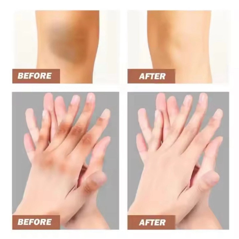 Aromixe 7 Day Whitening Serum 50ml for Knuckles, Feet, Elbows,