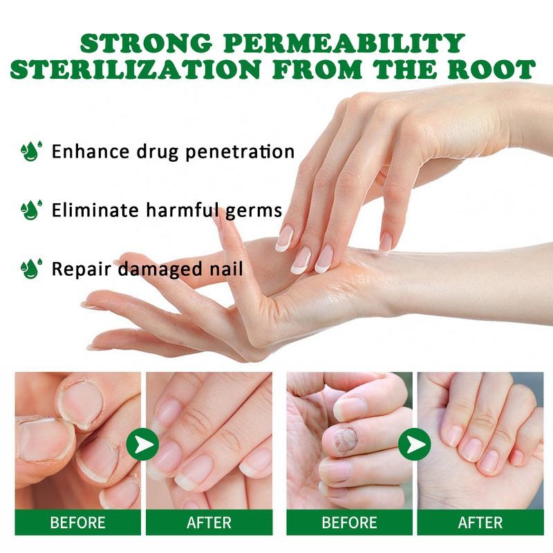JAYSUING Ginger Nail Treatment-Vitamin E & Plant Extracts for Repairing