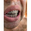 Solid 925 Sterling Silver Real Baguette Grillz - Iced Baguette