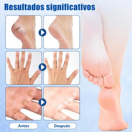Crema Hidratante Para Pies, Crema Hidratante Para Pies Resecos，Exfoliante E Hidratante, Elimina Eficazmente Callos Y Piel Gruesa (40 g) (2)