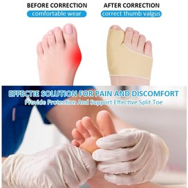 Bunion Corrector,2 Pcs Orthopedic Bunion Correctors Big Toe Straightener Bunion Relief Sleeves Separator Hallux Valgus Protectors Bunion Splints Support Sleeve Feet Bandage for Men and Women