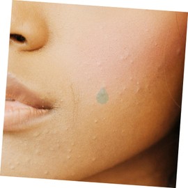 Baluue 2sheets Hydrocolloid Facial Patches for Pimple Removal Ultra-thin Tool for Daily Use Unique Shape for Smooth Skin