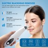 Blackhead Remover Vacuum for Nose & Face - Electric Pore