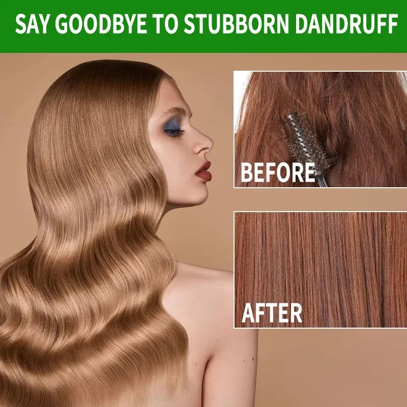 2026 Aceite De Batana Para Cabello Nutre Y Suaviza 30ml