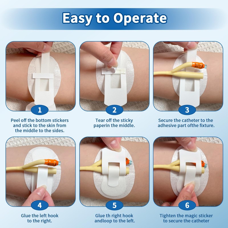 10 pcs Foley Catheter Stabilization Devices,Sterile Individually Packaged,Self-High Adhesive Catheter