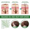 Aceite Capilar De Romero Ouhoe, Nutre Y Suaviza El Cabello