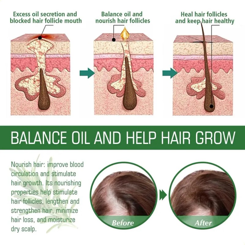 Aceite Capilar De Romero Ouhoe, Nutre Y Suaviza El Cabello