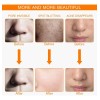 Máscara facial terapéutica LED ForeverLily Máscara de led -