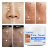 Crema Aclaradora Facial Moteada 50 G, Melasma Speckle Moistu