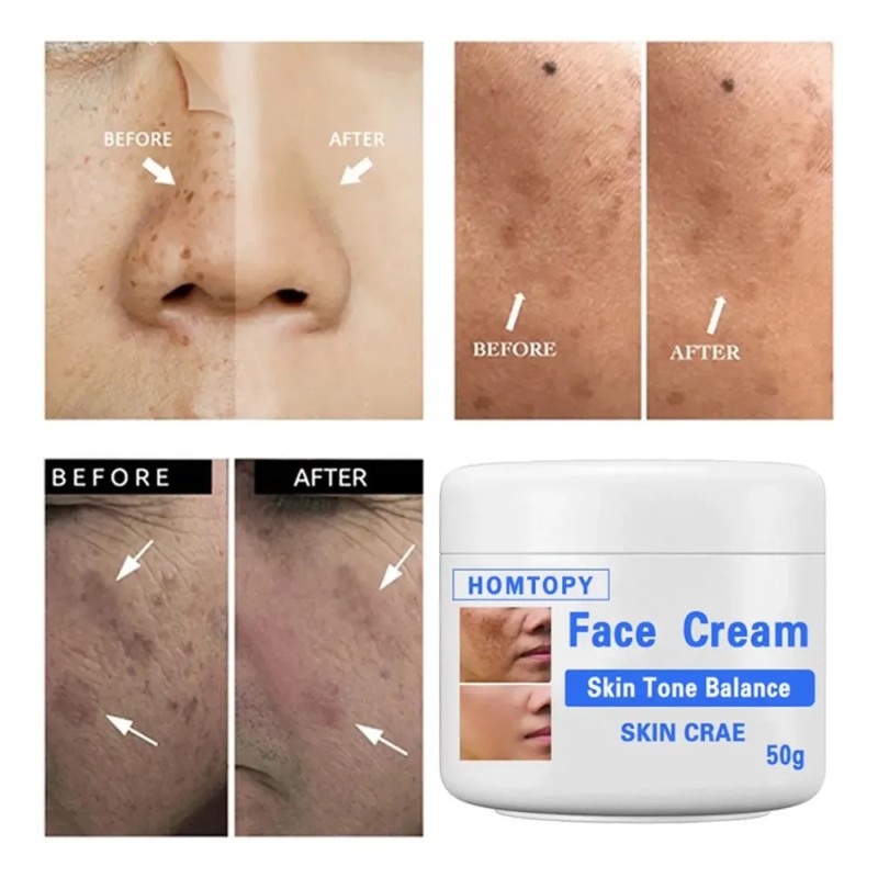 Crema Aclaradora Facial Moteada 50 G, Melasma Speckle Moistu