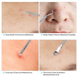 Blackhead Remover Pimple Popper Tool Kit for Pimple Blemish Comedone Acne Zit Whitehead Face Chin Noze Forehead Cheek Body VCXN