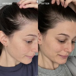 Vida Glow - Natural Hydrolysed Marine Collagen Sachets | Promotes Glowing Skin + Smothes Fine Lines (Original, 14 Sachets)