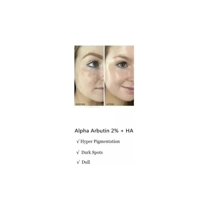 Serum Despigmentante Alfa Arbutina 2%+ Ha | Suero Iluminador
