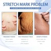Pregnancy Stretch Mark Cream | OB-GYN Recommended Formula for Reducing