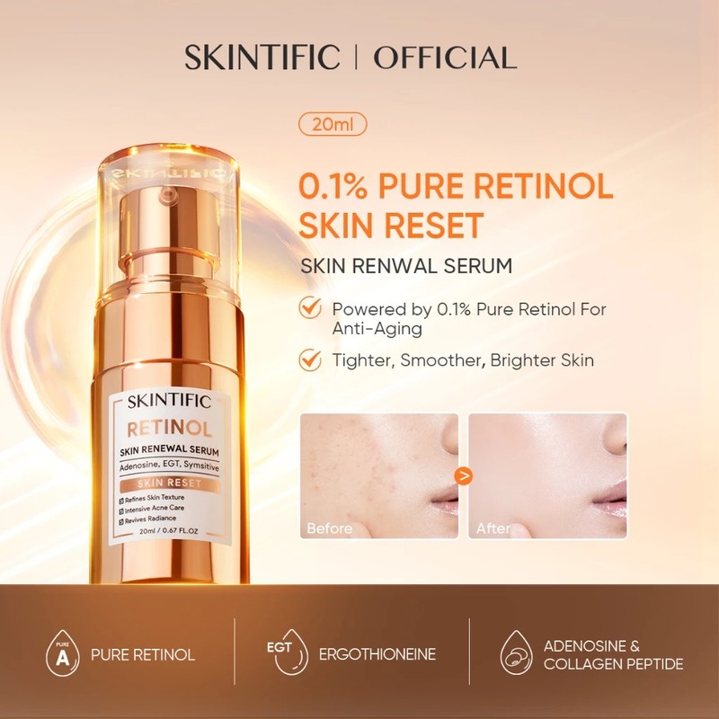 SKINTIFIC Retinol Anti-Aging Serum – Brightening & Dark Spot Correcting