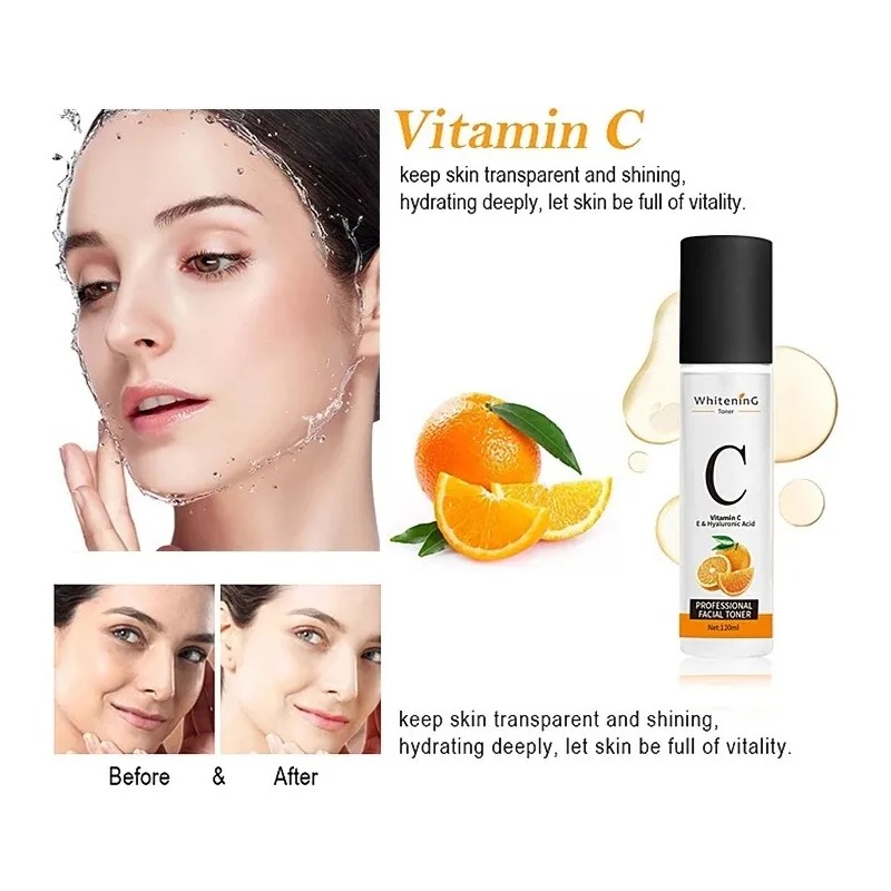 Suero Vitamina C Aclarante Anti Acné Limpia Humecta Tu Piel