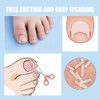 TSUOUKLSet zur Korrektur eingewachsener Zehennägel - 40 Stück schmerzfreie Zehennagelglättungsstreifen