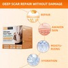 Silicone Scar Sheets (1.6"x 79" Roll-2M), Reusable Scar Silicone Strips