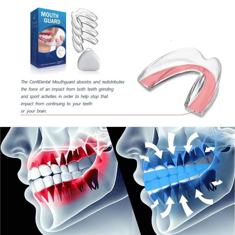 FIREYUN Mouth Guard for Grinding Teeth and Clenching Anti Grinding