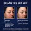 Pca Skin Hydramatte