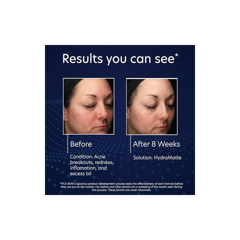 Pca Skin Hydramatte