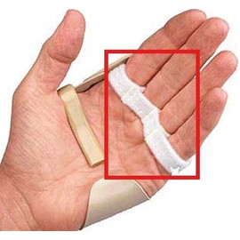 3pp Radial Replacement Straps - 2 Count - Small/Medium