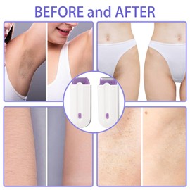 Focusing Silky Smooth Hair Removal Portable Painless Hair Eraser Tool Rechargeable Epilator Smooth Touch Hair Remove Applicable to Any Part of Women & Men's Body 1 PCS