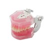Dental Demonstration Teeth Model - Tooth Extraction Model Standard Study